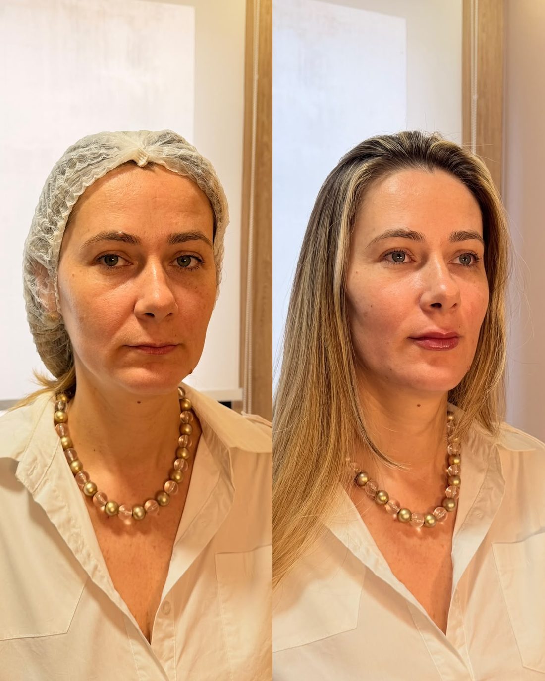 Bioreconexão, perfil